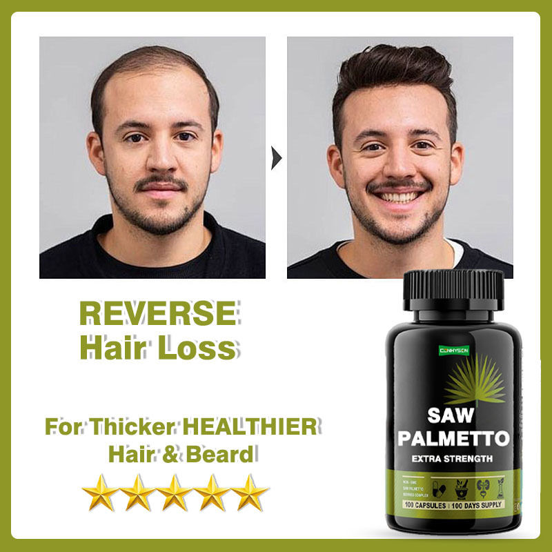 Nhà sản xuất bổ sung Saw Palmetto Capsules Extra Strength For Reduces Hair Loss Hỗ trợ tăng trưởng