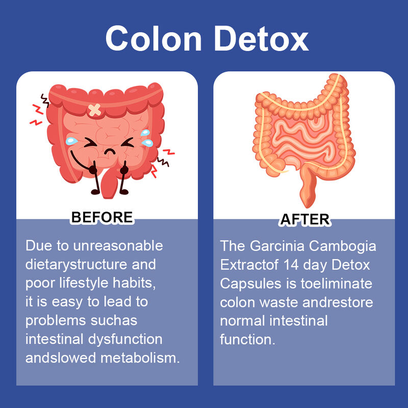 Nhãn riêng 14 ngày Slim Capsule hỗ trợ sức khỏe tiêu hóa và giảm cân bổ sung chế độ ăn uống Detox Capsules